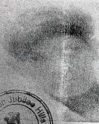 Person