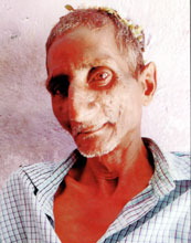 Person