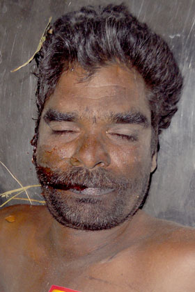 Person