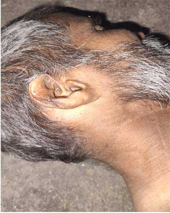 Person