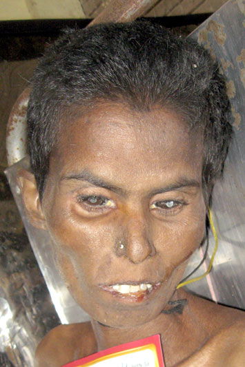 Person