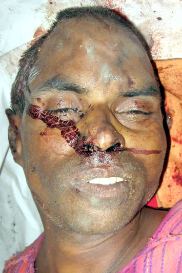 Person