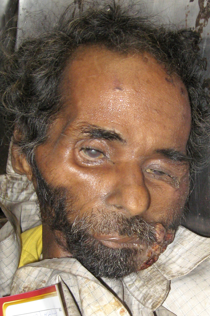 Person
