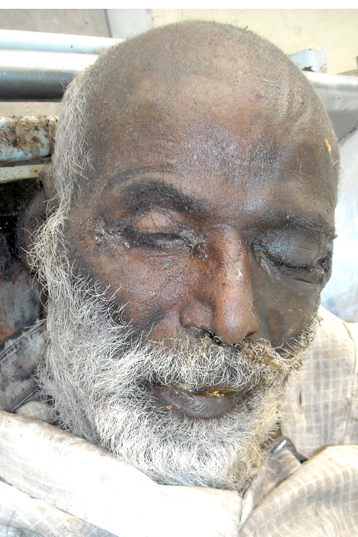 Person