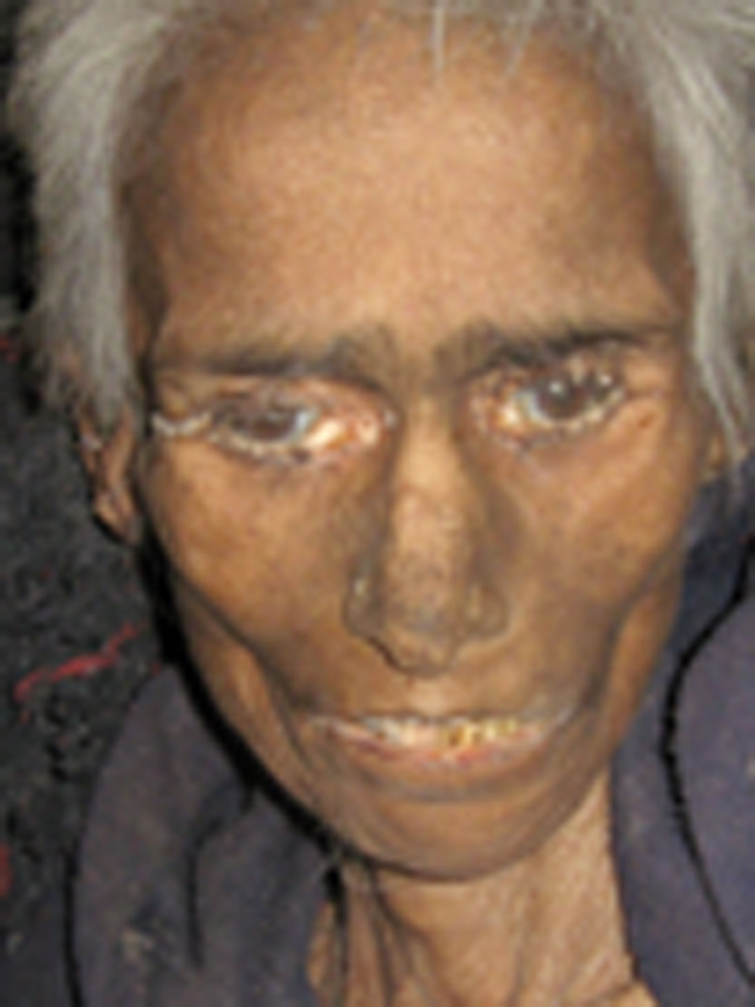 Person