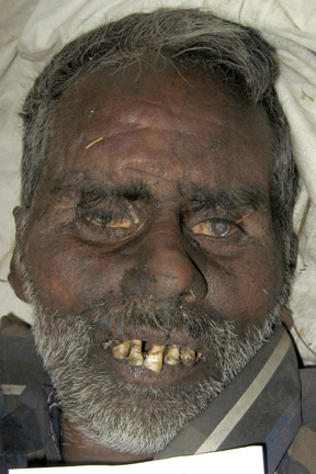Person