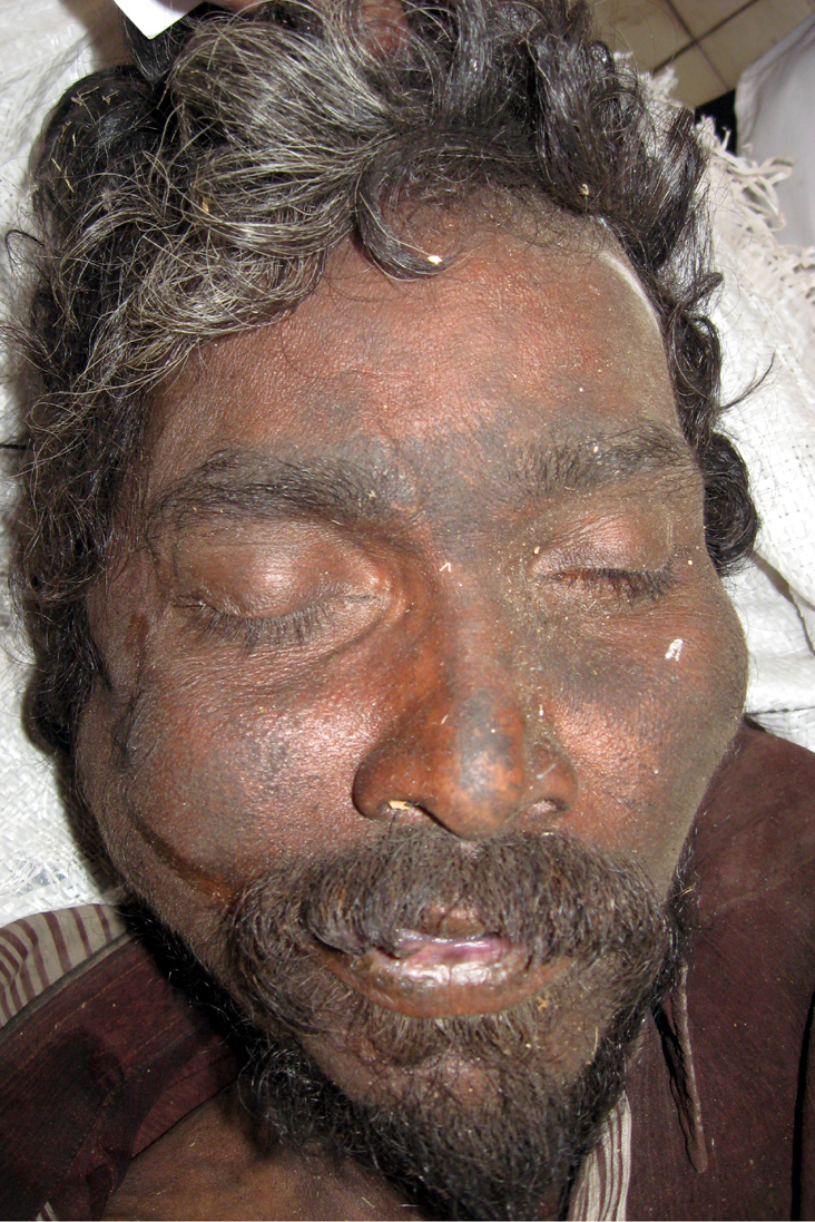 Person