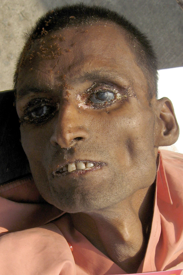Person