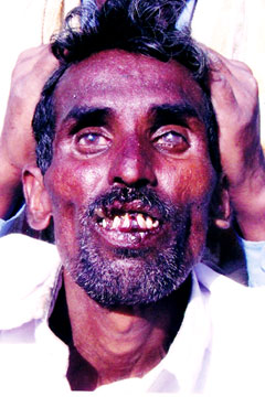 Person