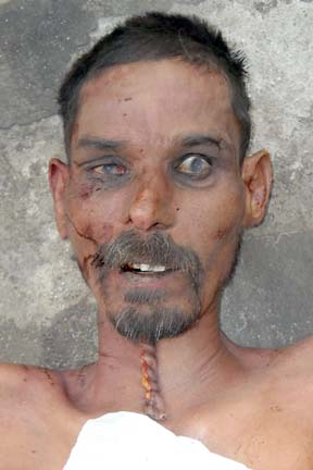 Person