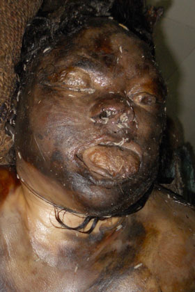 Person