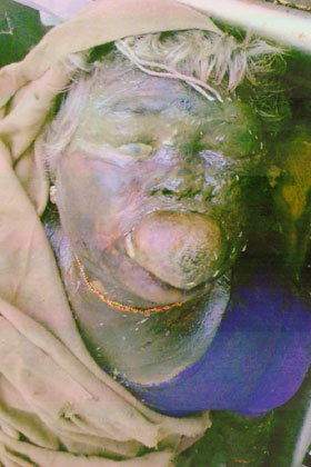 Person