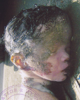 Person