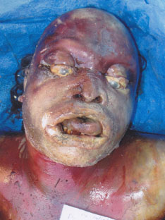 Person