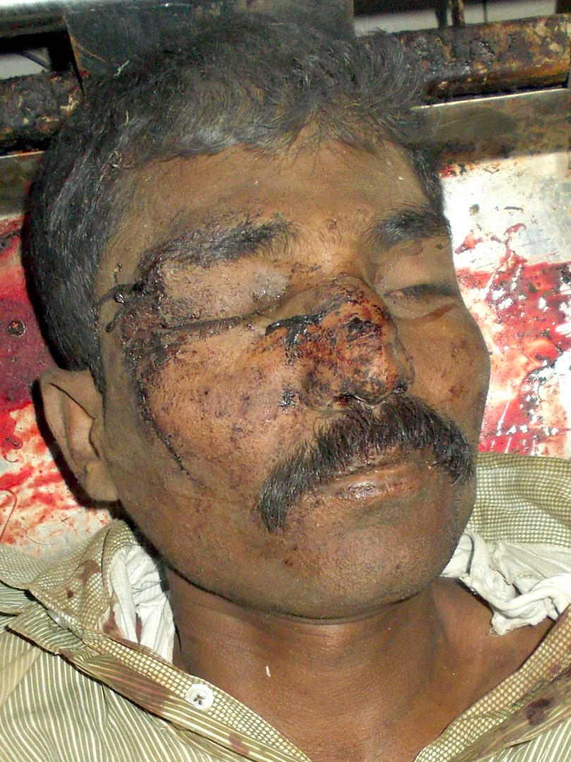Person