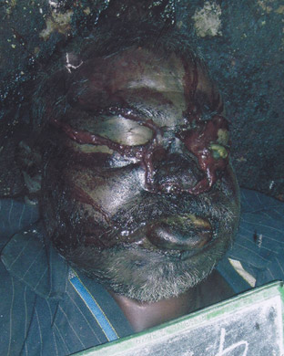 Person