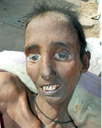 Person
