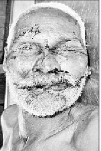 Person