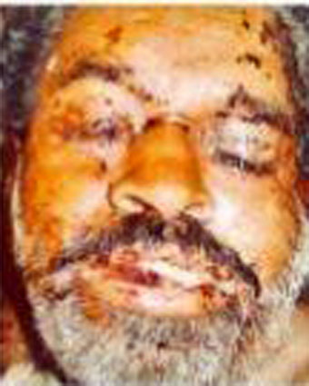 Person
