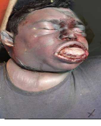 Person